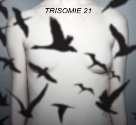 Trisomie 21: DON'T YOU HEAR? CD